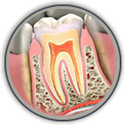 Root Canal Treatment Don Mills